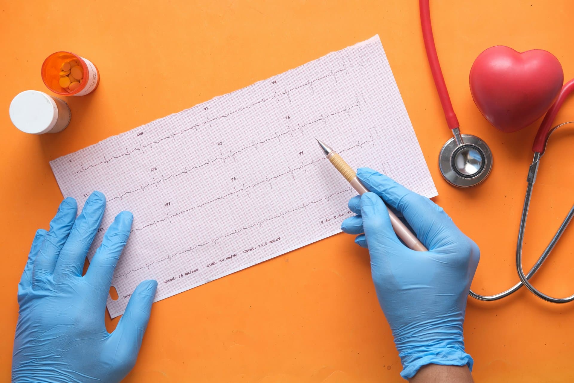 a topshot of doctor hands checking ECG report